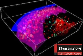 İnsan bədənində yeni orqan aşkarlandı