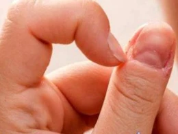 Qadınlarda xərçəng xəstəliyinin 20 əlaməti