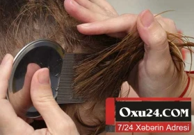 Anaların kabusu: uşağın saçına bit düşərsə..