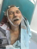 Bakıda ölən piyadanın yaxınları axtarılır - FOTO