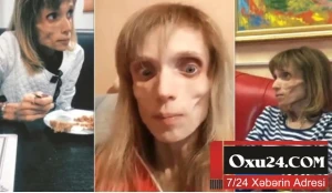 26 yaşı var, amma 17 kiloqramdır – Fotolar