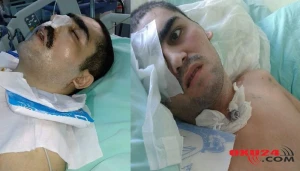 Komada   olan   aprel  döyüşçümüz   Türkiyəyə  göndərilir - Nazirlik hərəkətə keçdi