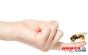 Sumqayıtda hamilə qadını arı sancdı - Şoka düşdü