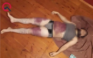 “Cinçıxarma” adı ilə qətlə yetirilən Muradın cəsədinin - Fotoları