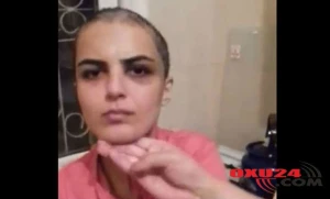 Ərinin “xəyanət”ə görə saçını keçəl etdiyi qadın danışdı — “Məni lüt soyundurdular, sonra saçlarımı kəsdilər” +VİDEO