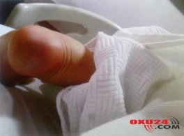 Doğum evində hamilə qadının ayağını yandırdılar - FOTO