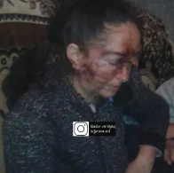 Şəmkirdə ər arvadını içki şüşəsi ilə vəhşicəsinə döydü - FOTO