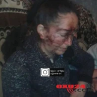 Şəmkirdə ər arvadını yatdığı yerdə vəhşicəsinə döydü - FOTO