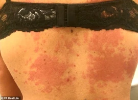 İçki içən qadın "yanmağa" başladı - FOTOLAR