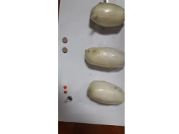 İrandan Azərbaycana düz bağırsağında narkotik keçirmək istədi