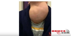 Xəstənin zobu həkimi də dəhşətə saldı