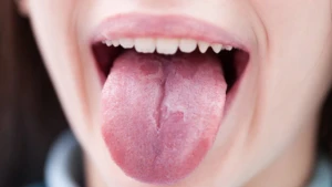 Dil nə zaman qanayır?