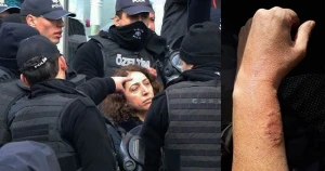 Şok görüntü! Qadın millət vəkili polisin qolunu dişlədi