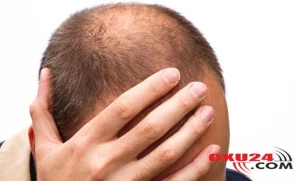 Saçı tökülənlər MÜTLƏQ OXUSUN — 3 MÜKƏMMƏL RESEPT Cəmiyyət