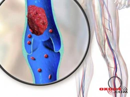 Paşinyanın arvadı və qızı Belçikada 100 min dollarlıq... - Şok iddia