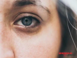 Göz altı qaraları yox edən MÖCÜZƏVİ MASKA