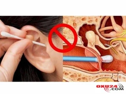 Qulağını çöplə təmizlədi, kəlləsində absess yarandı - Unikal hadisə