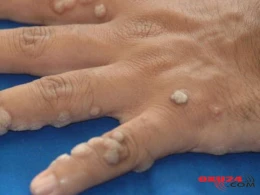 Ziyilləri necə apara bilərik? - 2 qaşıq sodanı.