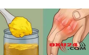 Oynaqları ağrıdan birdəfəlik XİLAS EDƏN TƏBİİ VASİTƏ - İnanılmaz NƏTİCƏ