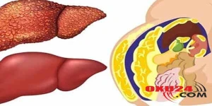 Hər evdə olan bu adi 3 məhsul qaraciyəri xəstəliklərdən qoruyur