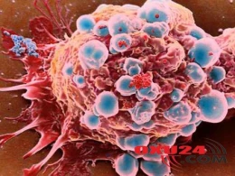 Xərçənglə mübarizədə ən yaxşı vasitə açıqlandı - Hər evdə var