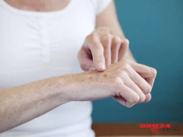 Qəhvəyi ləkələrin sirri - Müalicəsi varmı?