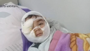 Bakıda DƏHŞƏT - İt 4 yaşlı uşağı parçaladı