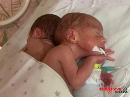 Bakıda dördəm dünyaya gəlib - FOTO