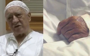Fətullah Gülən intihara cəhd edib? - Xəstəxanadan foto yayıldı