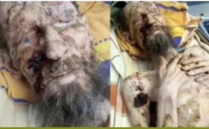 Ayıların parçaladığı şəxs bir ay sonra mağaradan sağ tapıldı