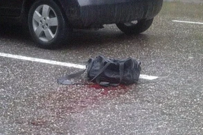 Gəncədə avtobus 2 yaşlı uşağın ayaqlarının üzərindən keçib