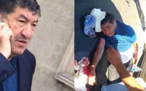 Hacı Mazanın vəziyyəti ağırlaşdı - Həkimlər onu əməliyyat edə bilmir