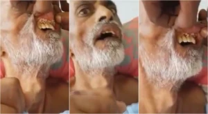 ŞOK görüntü: Dəhşətli xəstəlik yayılıb, qurdlar insanı belə yeyir