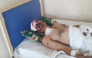 "Kamaz" təkəri partladı, ustanın gözü çıxdı - Ağstafada bədbəxt hadisə