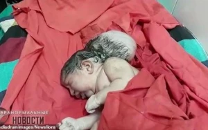 Üçbaşlı uşaq doğuldu - FOTOLAR