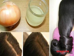 Saç tökülməsinə qarşı ən yaxşı maska