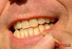 Stomatoloqdan diş çöpü XƏBƏRDARLIĞI