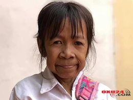 Xəstəlik 10 yaşlı qızı qoca qarıya çevirdi - FOTO