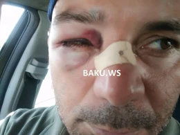 Bakıda jurnalistə hücum olub - ŞOK FOTO