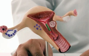 Ginekoloji xəstəliklər və menstruasiya pozulmaları - Səbəblər, müalicə