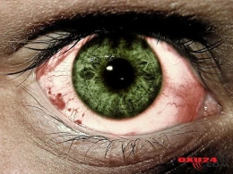 Quş parkda oynayan uşağın gözünü tökdü - Sağsağanların təhlükəli olduğu barədə...