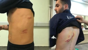 Futbolçular arasında kütləvi dava: Yaralılar var