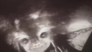 Uşağın cinsiyyətini öyrənmək üçün həkimə gedən ana həyatının şokunu yaşadı...