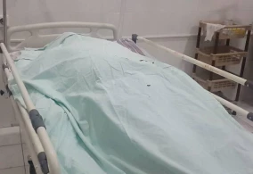 Bakıda qadın göz əməliyyatından sonra öldü