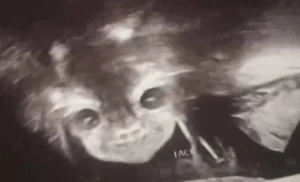 Körpəsinin cinsiyyətini öyrənmək üçün aparata girən ana ŞOKA DÜŞDÜ - Yadplanetli.../ FOTOLAR