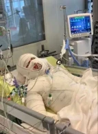 Azərbaycanlı mühacir Almaniyada intihara cəhd etdi