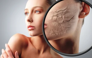 Dərisi quruyanlar, bu vasitəni atın – Nə istifadə etməli?