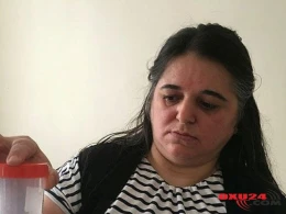 Qadının mədəsindən çıxan həkimləri şoka saldı