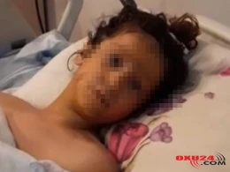 "Tok" vuran 9 yaşlı Zəhranın sol qolunu amputasiya etdilər