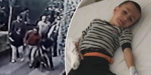 Parkda dəhşət: Pitbull uşağın qolunu parçaladı